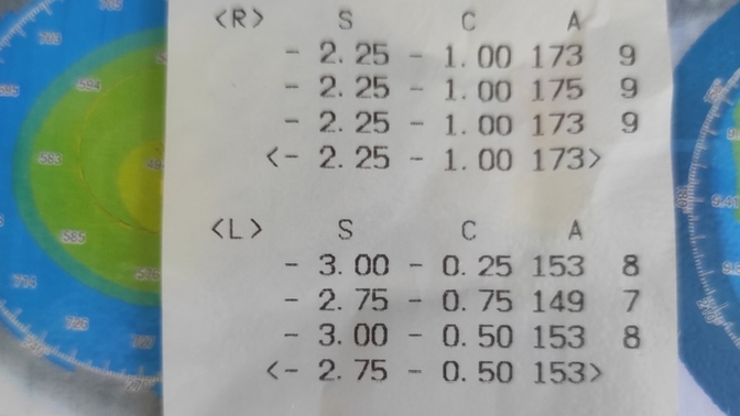 Göz mumaram kaç anlayan var mı arkadaşlar?