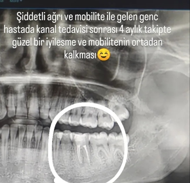 Çok sinirliyim beni dinler misiniz?