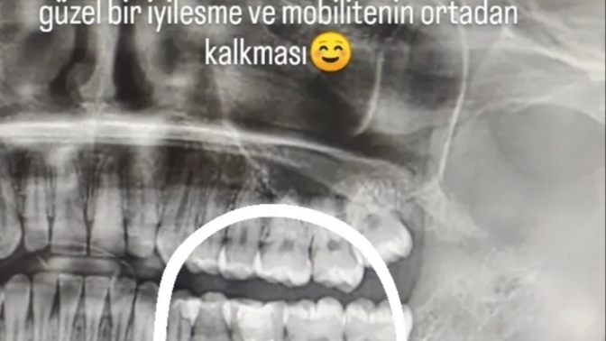 Çok sinirliyim beni dinler misiniz?