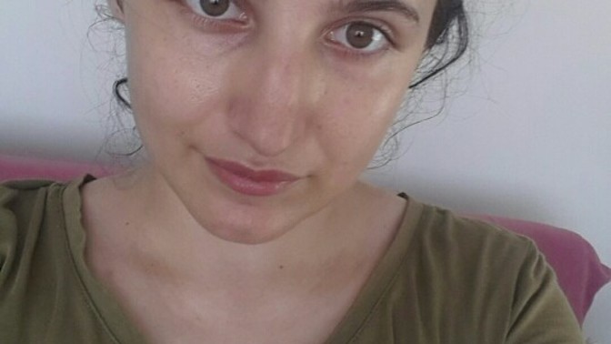Burnum çok mu kötü duruyor? Sizce yaptırmalı mıyım?