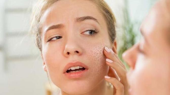 Cildinizde en çok hangi problemi yaşıyorsunuz?