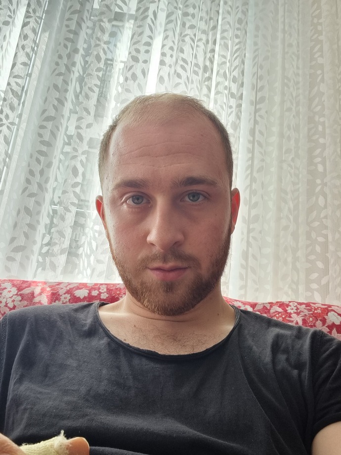 Botoks yaptırmalı mıyım?