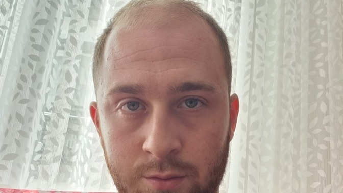 Botoks yaptırmalı mıyım?