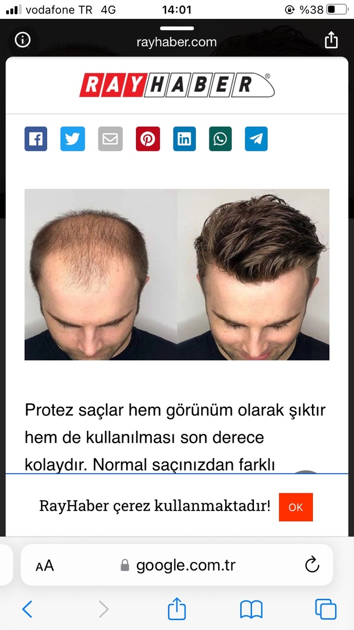 Protez saçı olan biri ile sevgili olur musunuz kızlar?