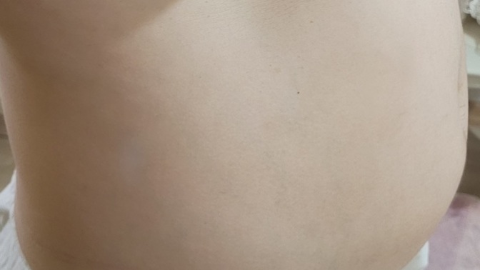 Sizce bu göbek mi bel ağrısı yapiyor (Resimli)?