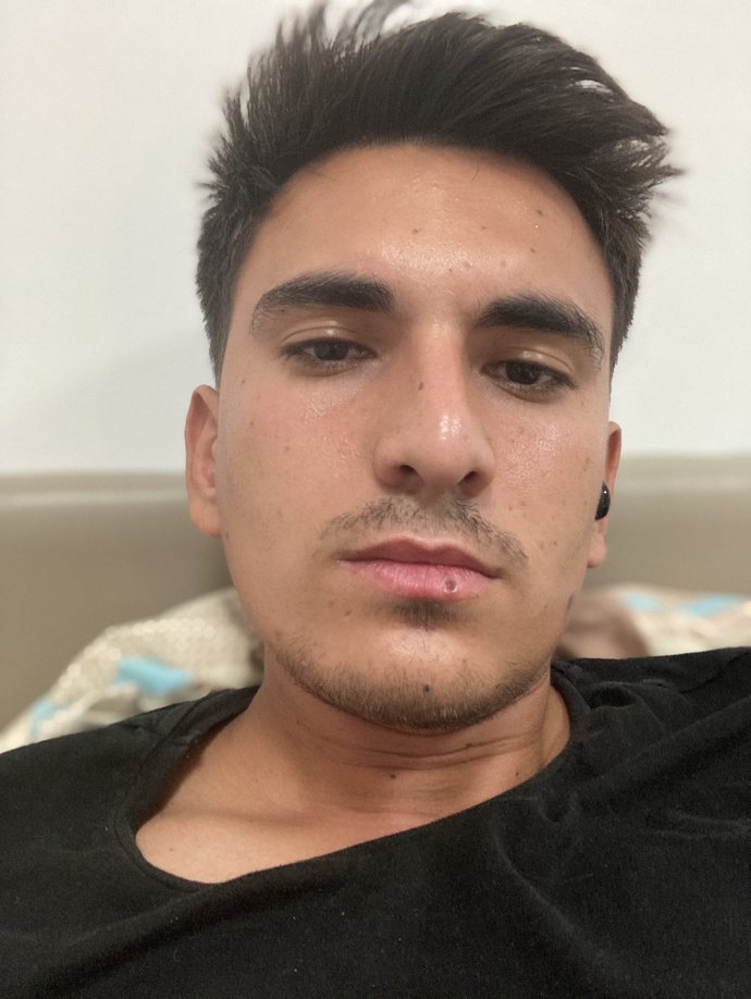 Dudak yaraları naısl geçer?