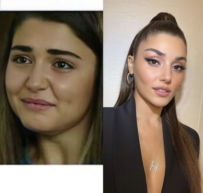 Keşke estetik olmasaymış daha güzelmiş dediğin ünlü var mı görsellerde?