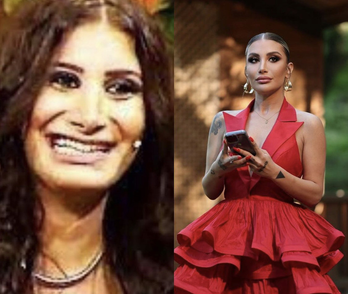 Keşke estetik olmasaymış daha güzelmiş dediğin ünlü var mı görsellerde?