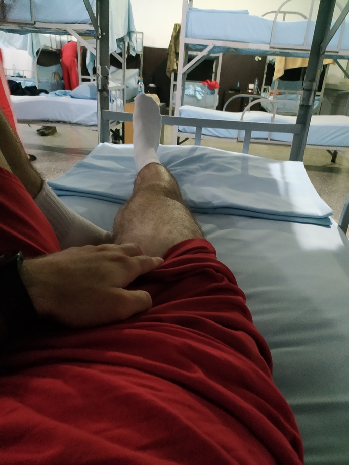 Bacak kıllarım çok mu, almalı mıyım?