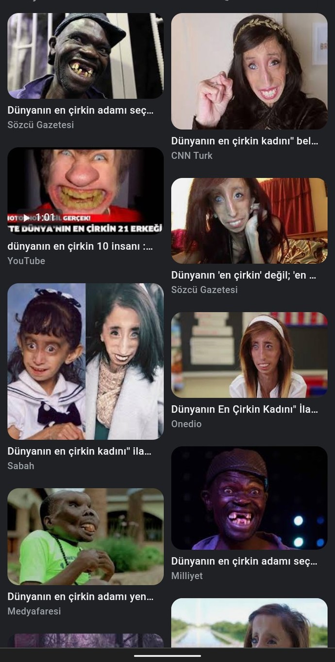 Dünyanın en çirkin insanı olman karşılığında dünyanın en zengin insanı da olacaksın. Kabul eder misin?
