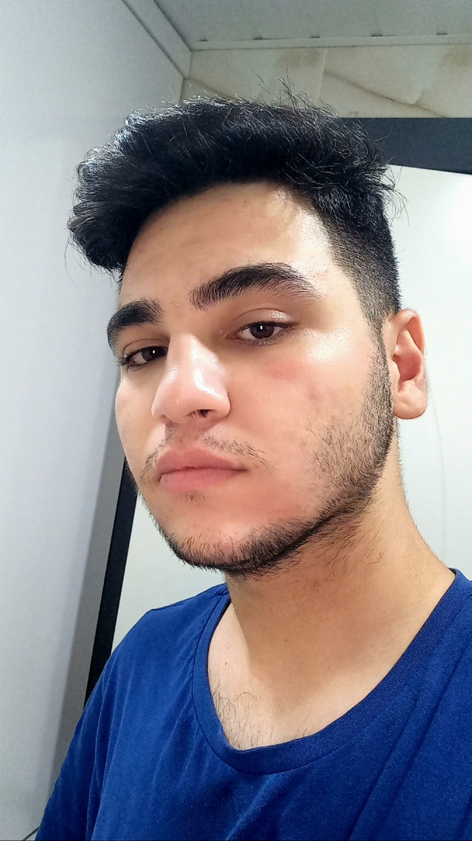 18 yaşındayım. Sakallarım var ama bazı yerlerde seyrek. Seyrek olan yerleri nasıl çoğaltabilirim?