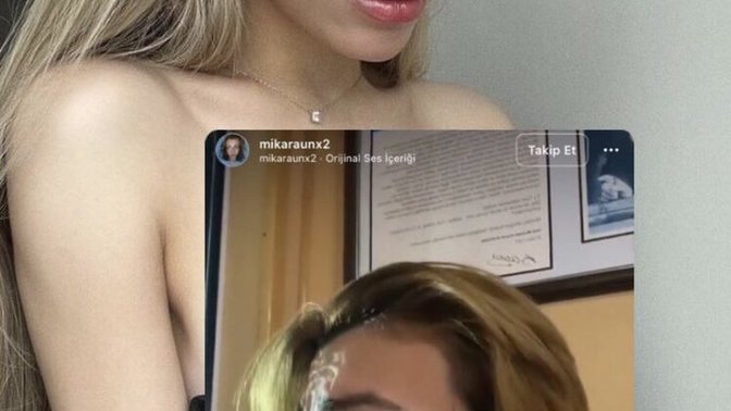Sevgilinin estetiğe ihtiyaçı olsa açık açık söyler misin kendisine?