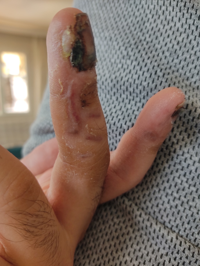 Sizce bu iz geçer mi polisliği düşünüyorum ama iş kazası geçirdim tüm hayalim berbat oldu bu iz geçer mi hangi bölüme gitmeliyim