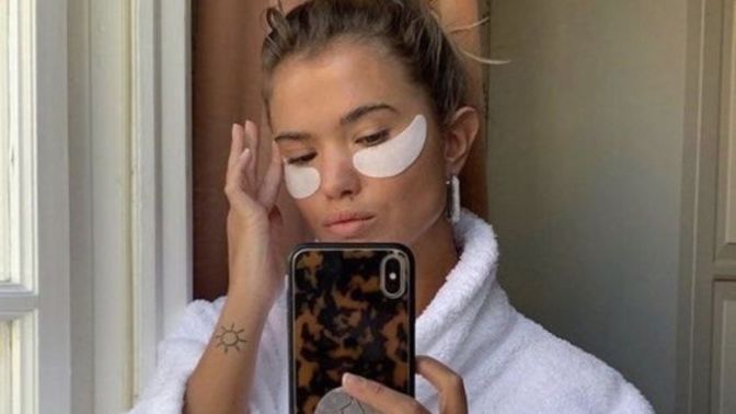 23 yaşındayım ama göz çevremde kırışıklıklar var. Bu normal mi?