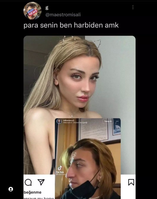 Paran varsa estetik olur muydun?