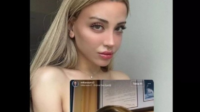 Paran varsa estetik olur muydun?