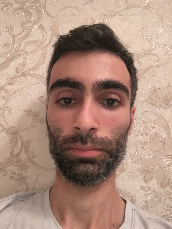 Kızlar sizce sakalda kı beyazlar çok mu belli oluyor?