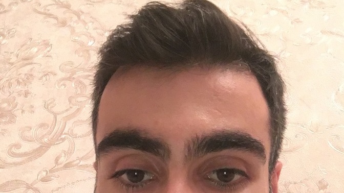 Kızlar sizce sakalda kı beyazlar çok mu belli oluyor?