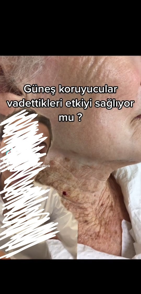 Güneş kreminin faydalarını biliyor musunuz?☀️⛱️ Kullanıyor musunuz?
