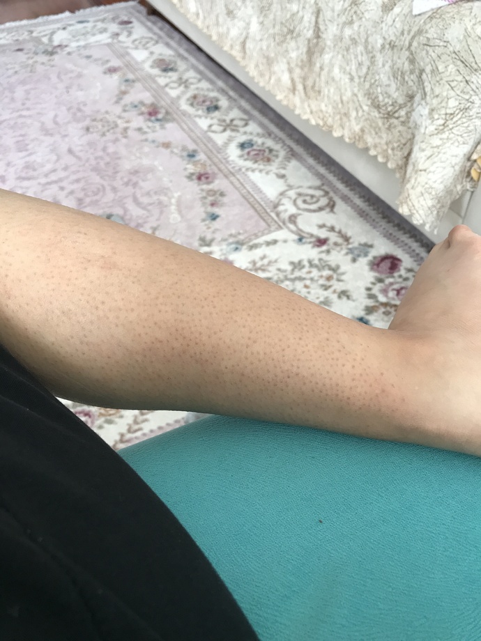 Bu bacak görüntüsünden nasıl kurtulabilirim?