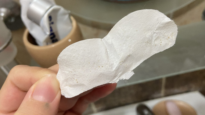 Cildimden çıkan şeye bakın, siz siyah noktalarınızla nasıl baş ediyorsunuz?
