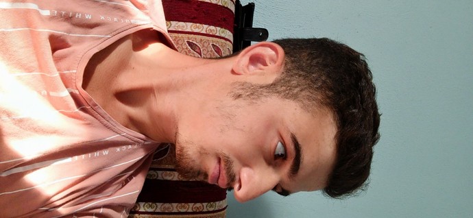 Burnumun estetiğe ihtiyacı var mı?