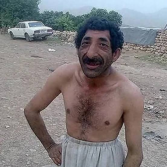 170 boyunda 100 kilo erkek nasıldır?