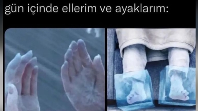 Tek değilimdir umarım 😂?
