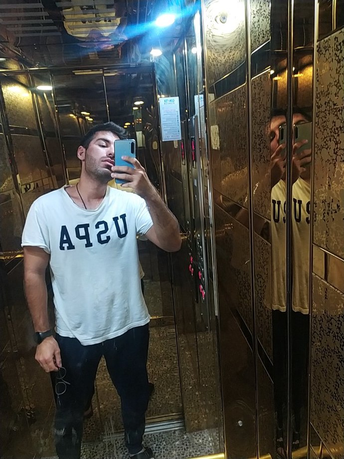 Sivilce izleri olan bir erkek yakışıklı olamaz mı?