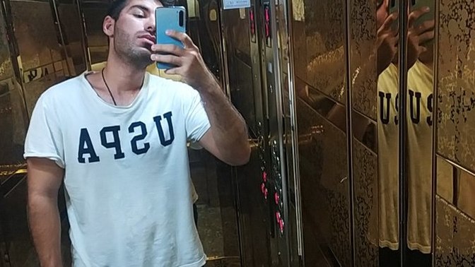 Sivilce izleri olan bir erkek yakışıklı olamaz mı?