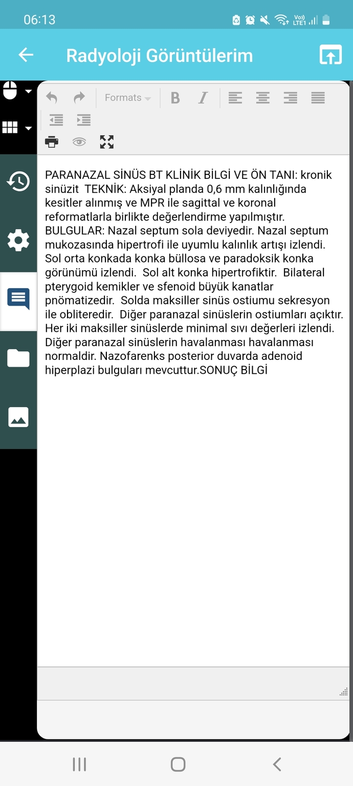 Paranazal sınus tomografi raporumu yorumlayabilecek biri var mı acaba?