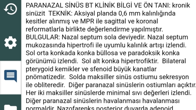Paranazal sınus tomografi raporumu yorumlayabilecek biri var mı acaba?