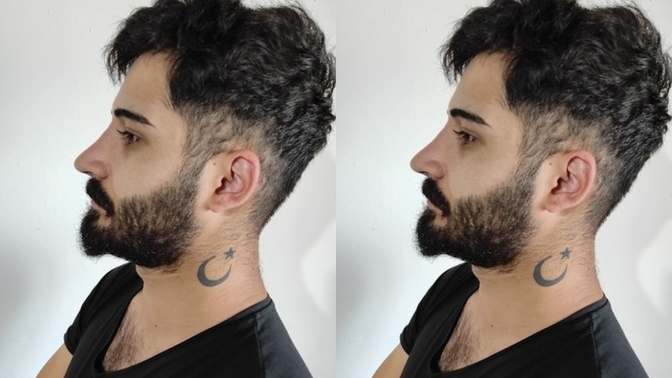 Burun estetiği oldum. Sizce burun şeklim bu şekilde güzel mi?