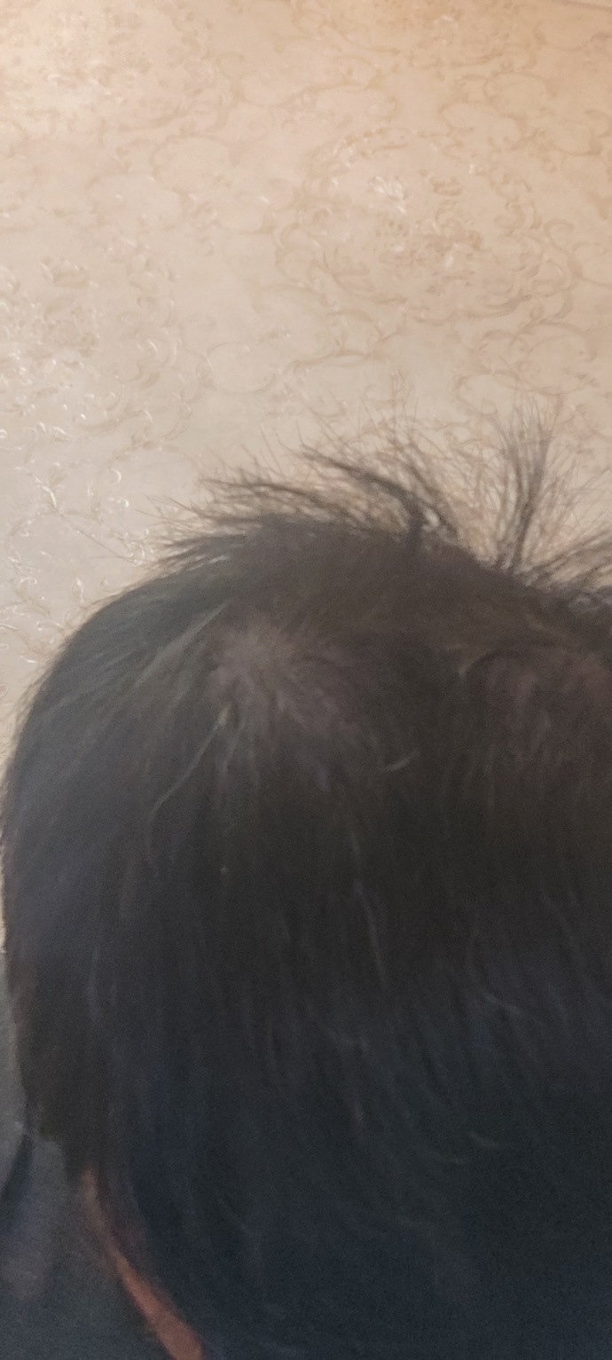Sizce saçlarımda kı bu durum nedir neyin alemetidir?