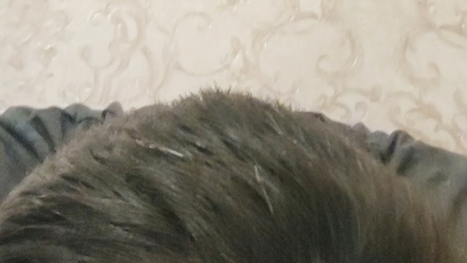 Sizce saçlarımda kı bu durum nedir neyin alemetidir?