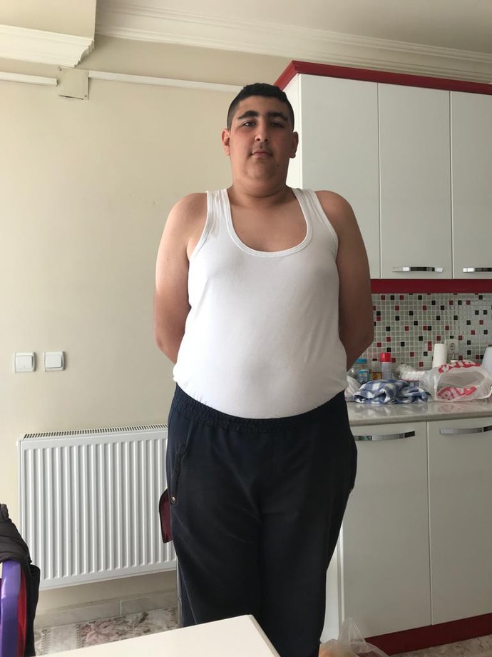 1.73 boyunda 98 kiloyum. Fazla kilolarım yüzünden çok mu kötü duruyorum?