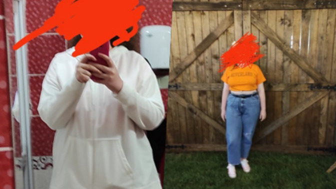 1.73 boyunda 98 kiloyum. Fazla kilolarım yüzünden çok mu kötü duruyorum?