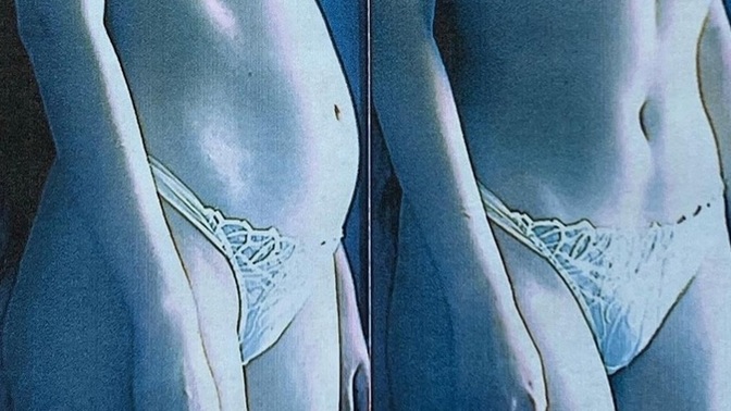 Göbeğinizi içeri çekermisiniz saklar mısınız fotoğraflarda veya günlük hayatta?