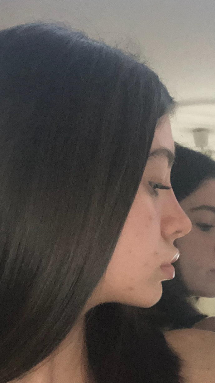 Yeni burnum nasıl olmuş, iyi mi sizce?