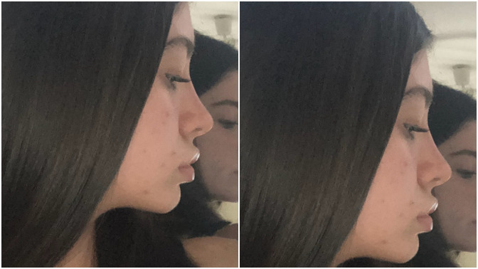 Yeni burnum nasıl olmuş, iyi mi sizce?