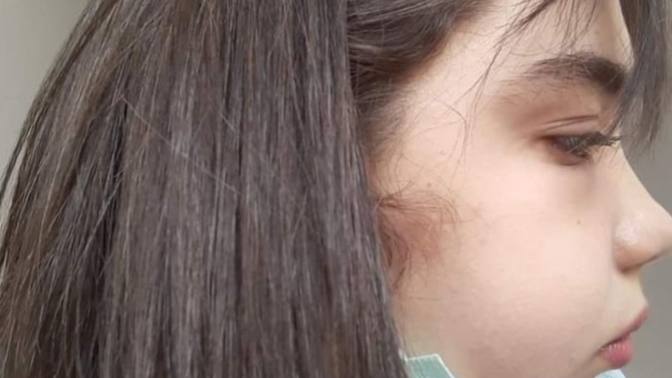 Yüzümün şiş olduğu çok belli mi?
