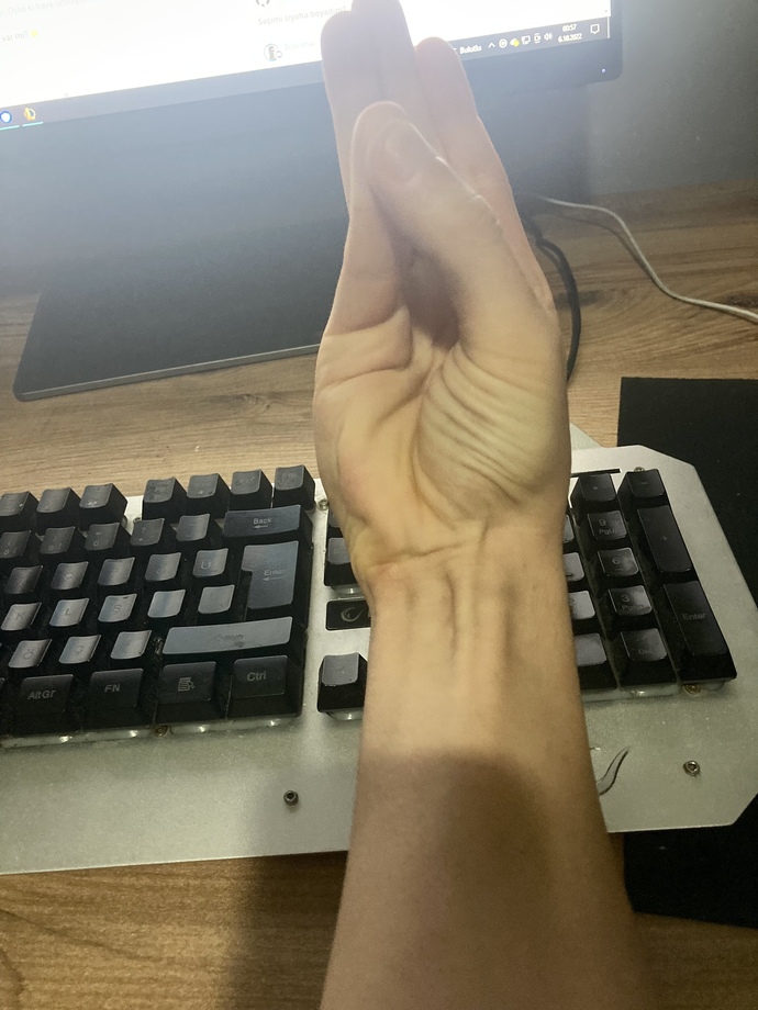 Öğrenmek İçin bu hareketi yapmayı deneyin. Palmaris Longus kasınız var mı?