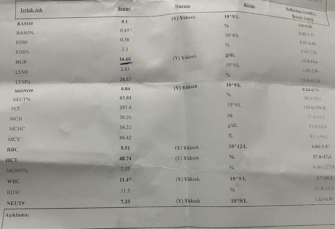 Bilen var mı çok üzülüyorum :(?