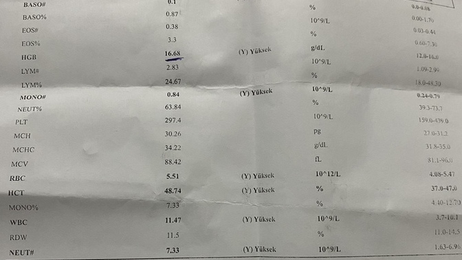 Bilen var mı çok üzülüyorum :(?