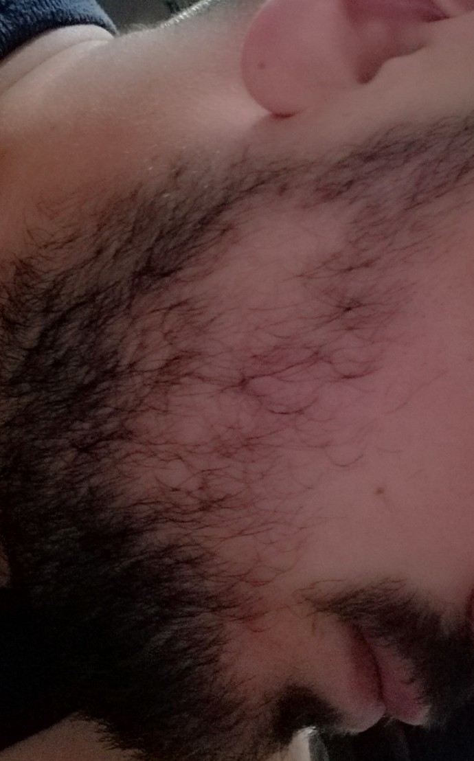 Arkadaşlar sakalım neden böyle açılıyor?