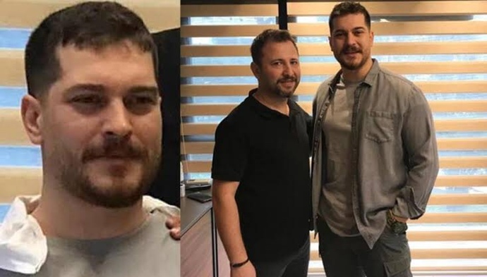 Çağatay Ulusoy’un bu sakal modeli nasıl sizce? Herkese yakışır mı bu model?