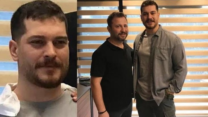 Çağatay Ulusoy’un bu sakal modeli nasıl sizce? Herkese yakışır mı bu model?