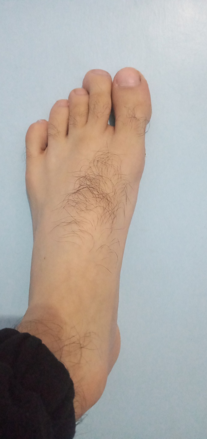 Ayağım neden eğri sizce?