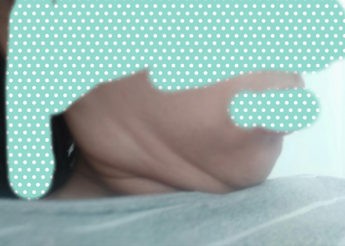 2.