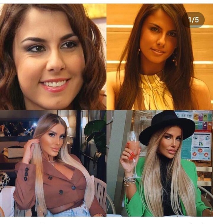 İnsanlar nasıl bu kadar ciltlerini güzelleştiriyor?